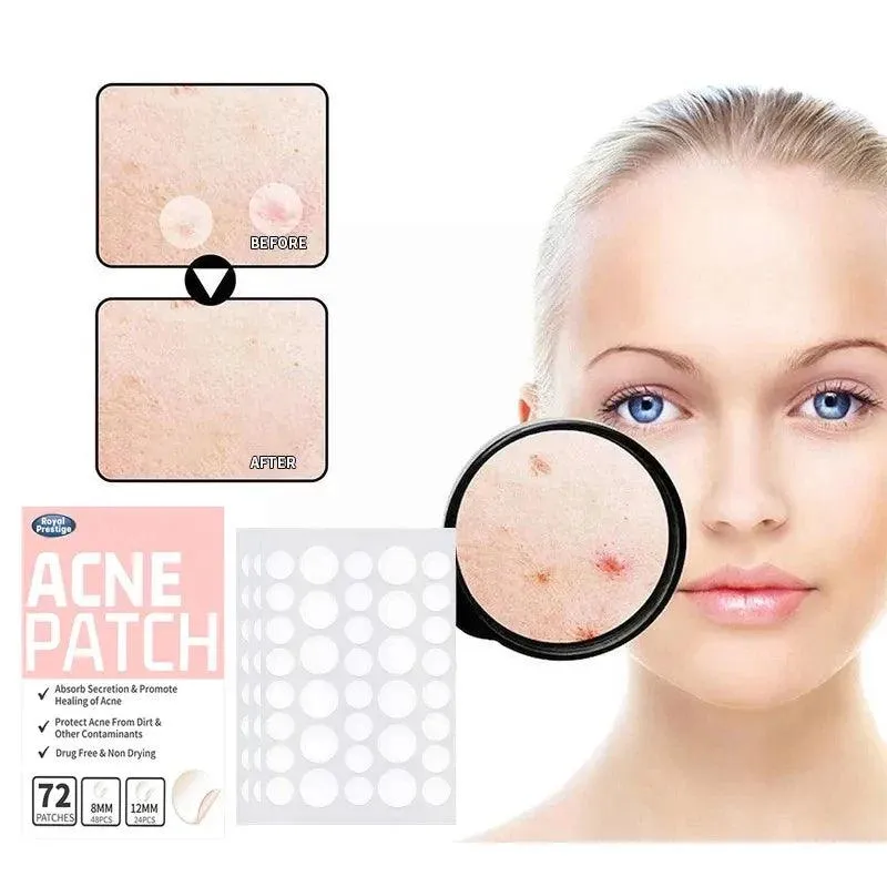 Advanced Hydrocolloid Acne Healing Patches for Rapid Clear Skin Restoration